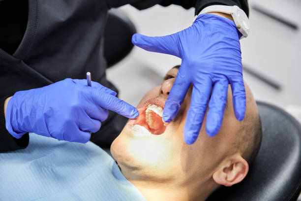 Best Dental Abscess Treatment in Morgans Point Resort, TX